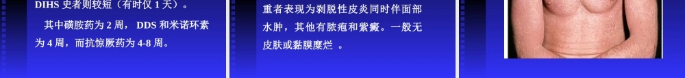 药疹.ppt.ppt