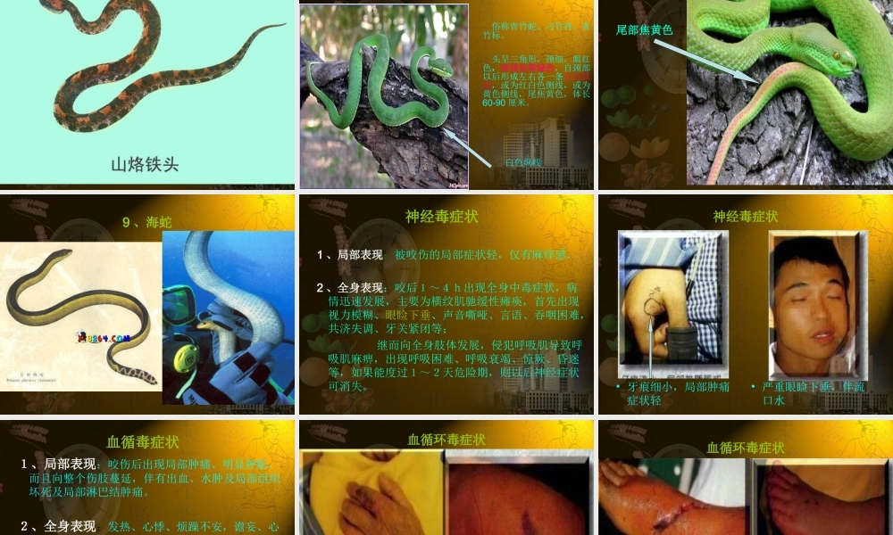 蛇咬伤诊疗常规.ppt