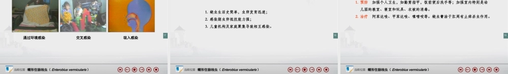 蠕形住肠线虫(蛲虫).ppt