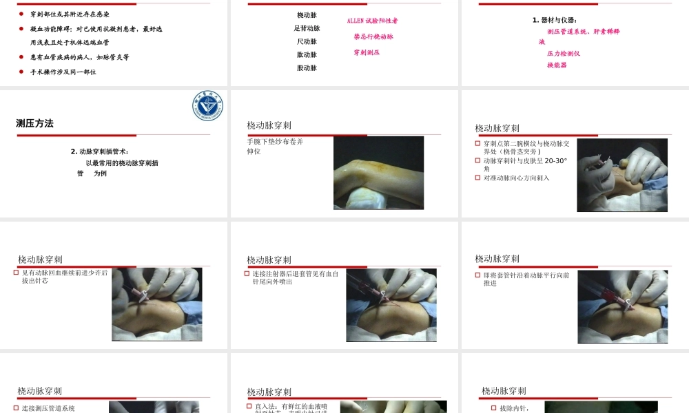 血压监测.pptx