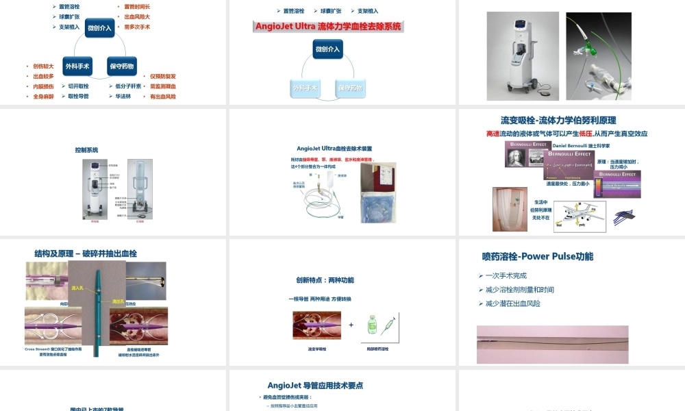 血栓抽吸系统.pptx