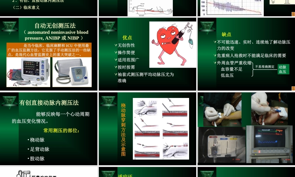 血流动力学监控-ppt.ppt