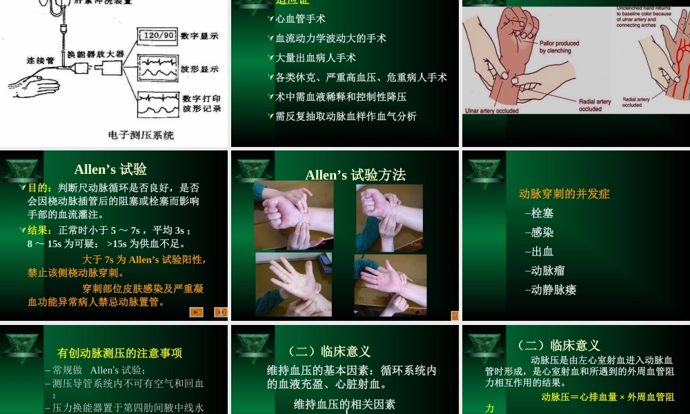 血流动力学监控-ppt.ppt