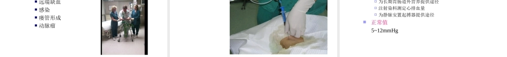 血流动力学监控.ppt