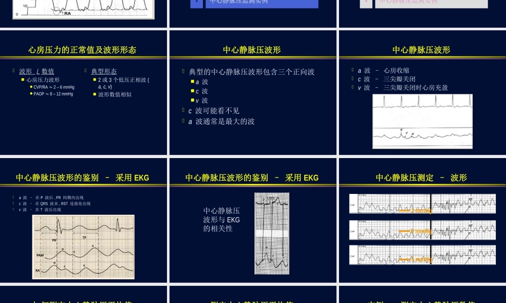 血流动力学监测波形分析.ppt
