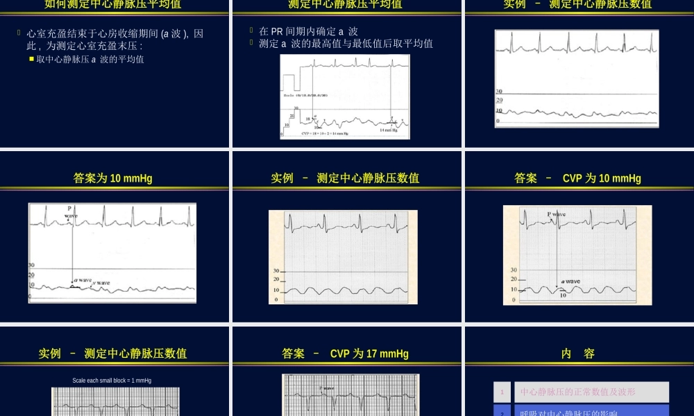 血流动力学监测波形分析.ppt