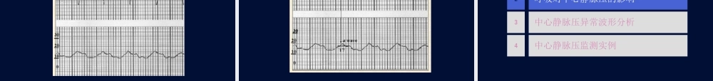 血流动力学监测波形分析.ppt
