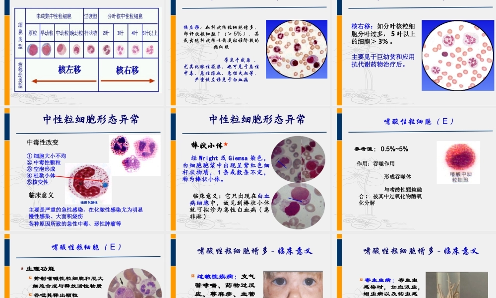 血液一般检测(白细胞).ppt