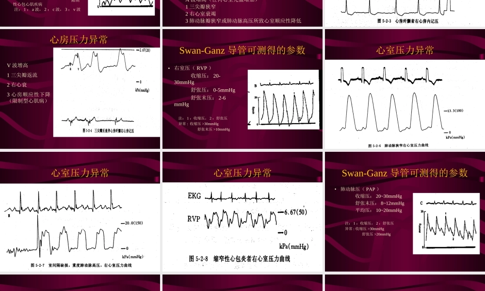 血液动力学监测.ppt
