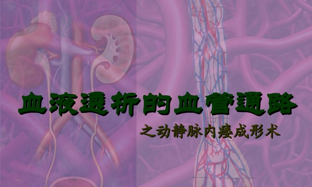 血液透析的血管通路分析.ppt