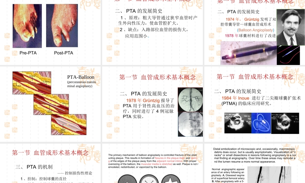 血管成形术及支架植入术.ppt