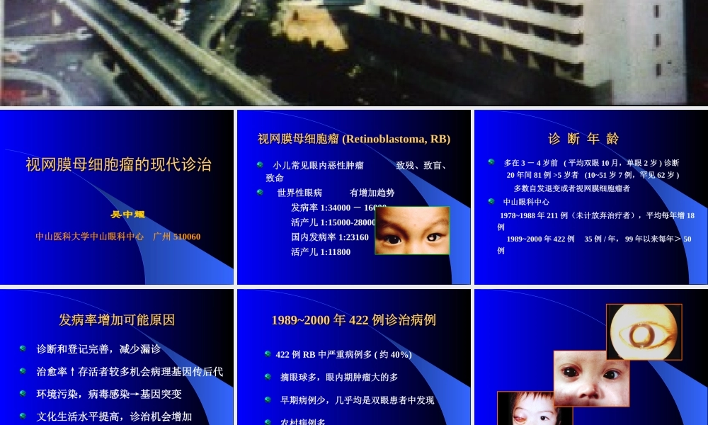 视网膜母细胞瘤的现代诊治.ppt