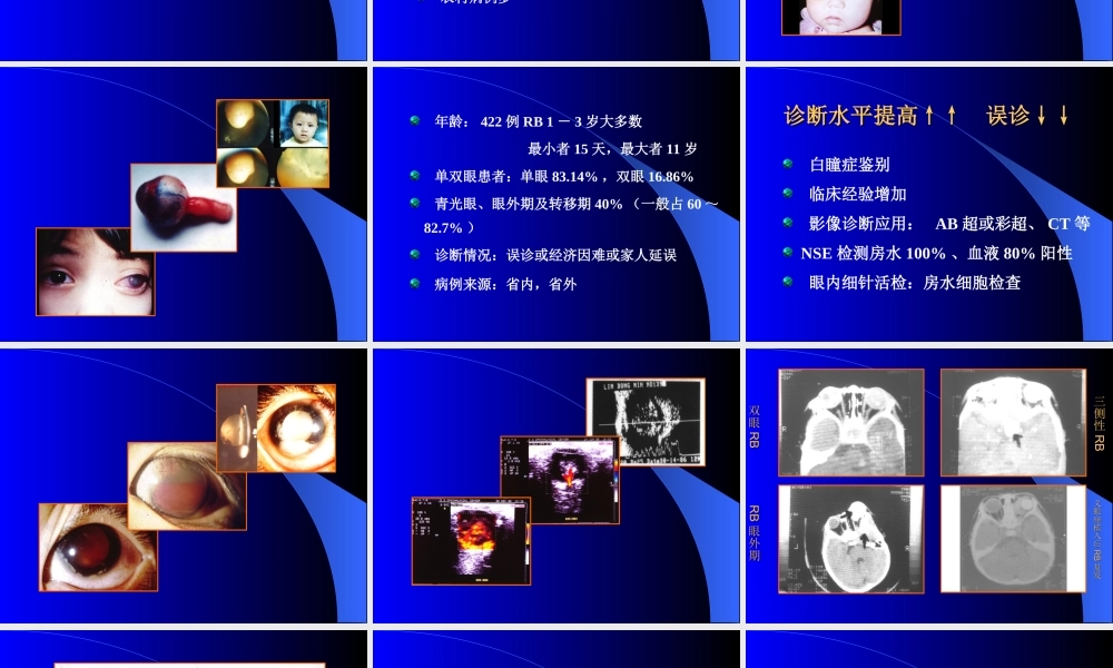视网膜母细胞瘤的现代诊治.ppt