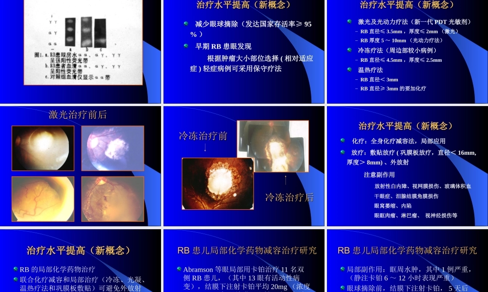 视网膜母细胞瘤的现代诊治.ppt