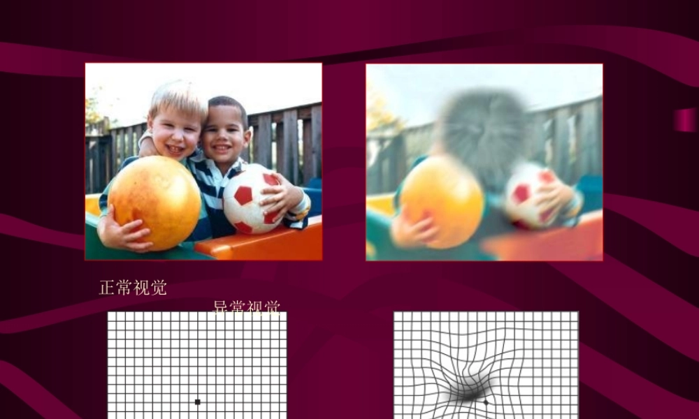 视网膜和视神经病2011.ppt