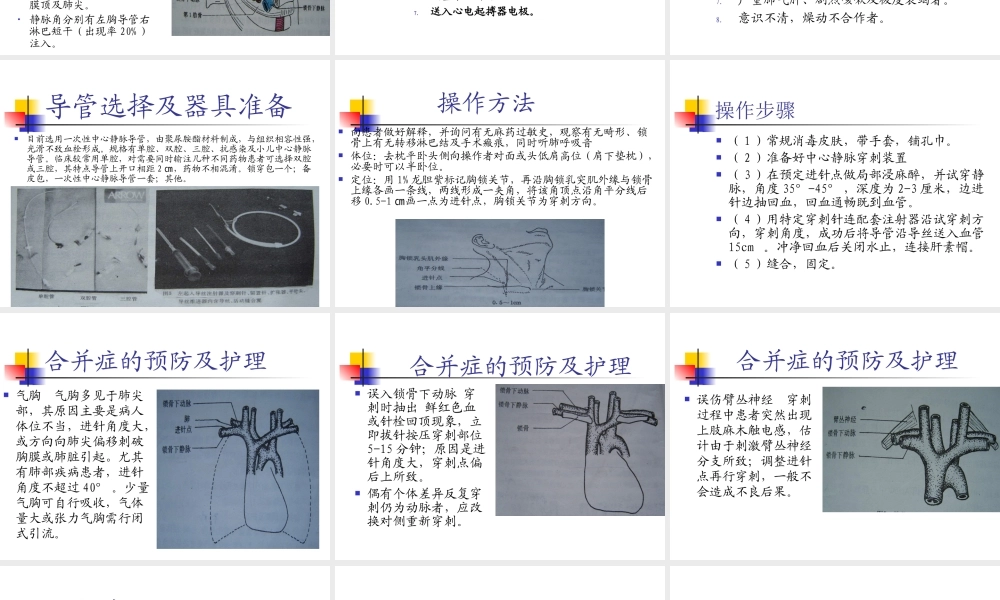 锁骨下静脉穿刺置管术.ppt