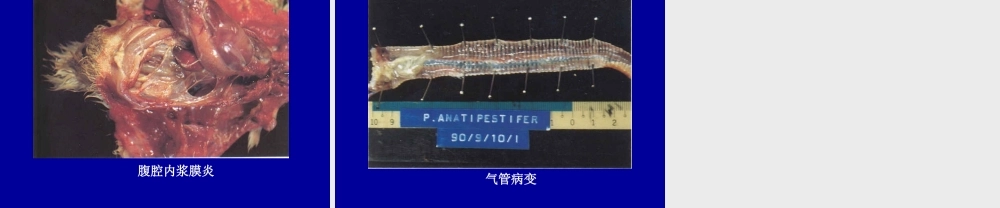 鸭疫里默氏杆菌病.ppt