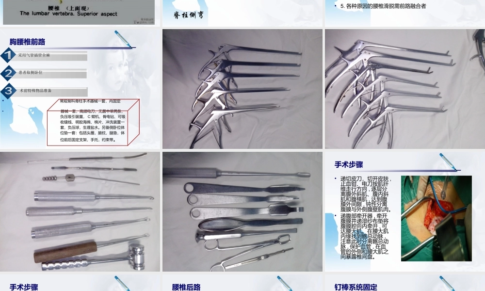 腰椎骨折前后路手术配合.ppt