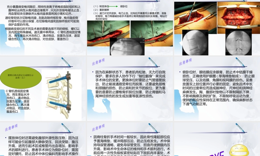 腰椎骨折前后路手术配合.ppt