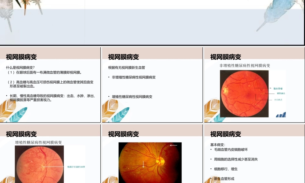 视网膜病变与周围神经炎症状及原因.ppt