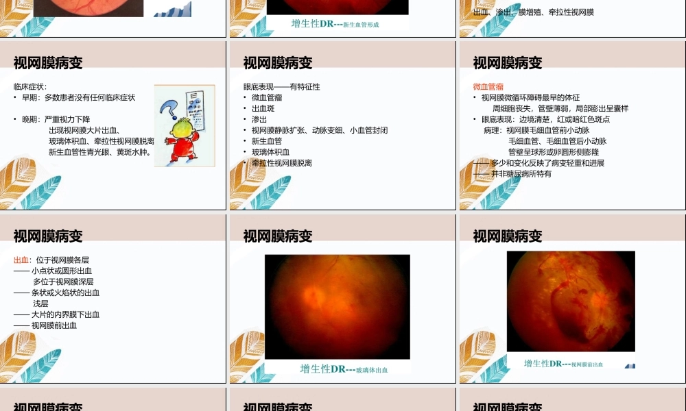 视网膜病变与周围神经炎症状及原因.ppt