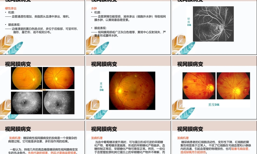 视网膜病变与周围神经炎症状及原因.ppt
