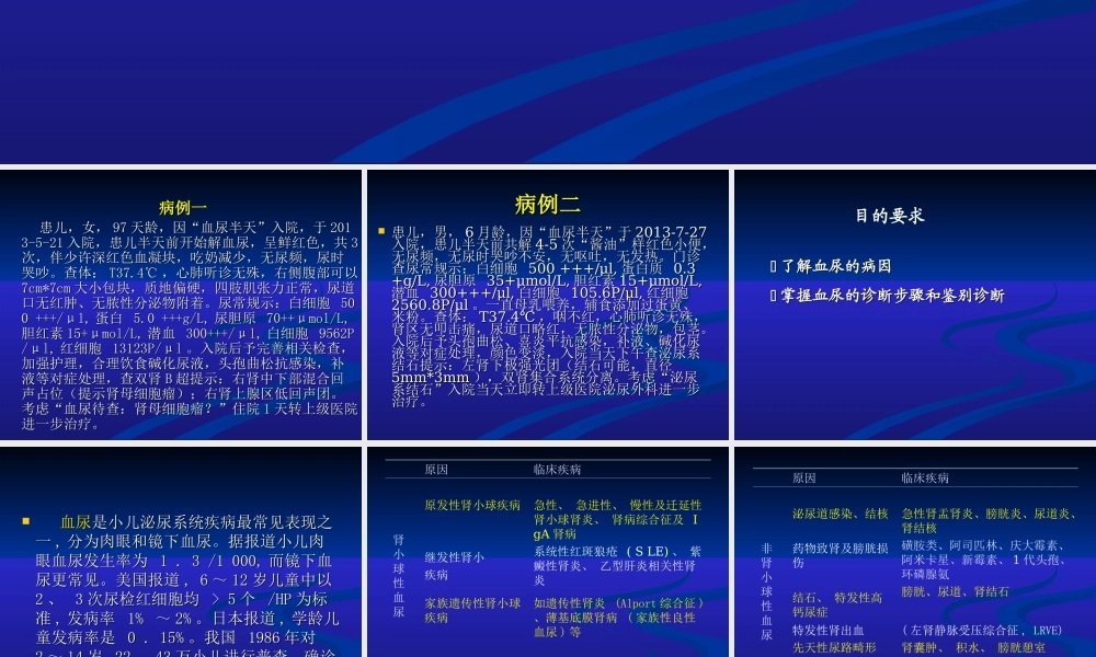 血尿原因待查.ppt