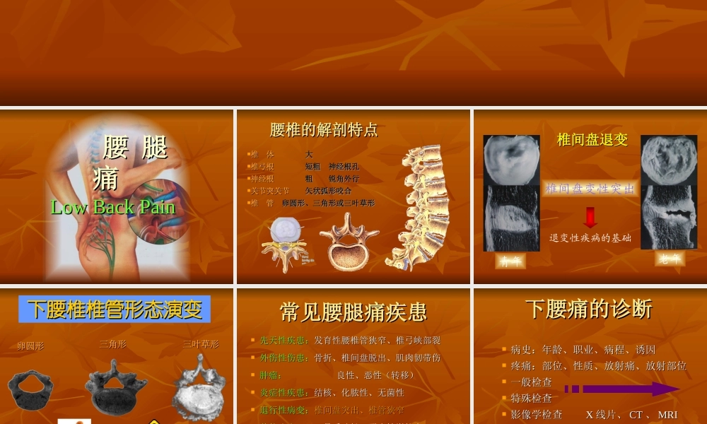 腰腿痛的诊治.ppt