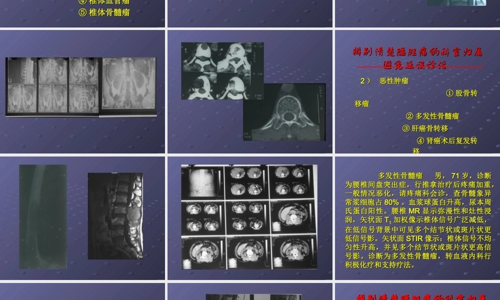 腰腿痛的辨析和处理.ppt