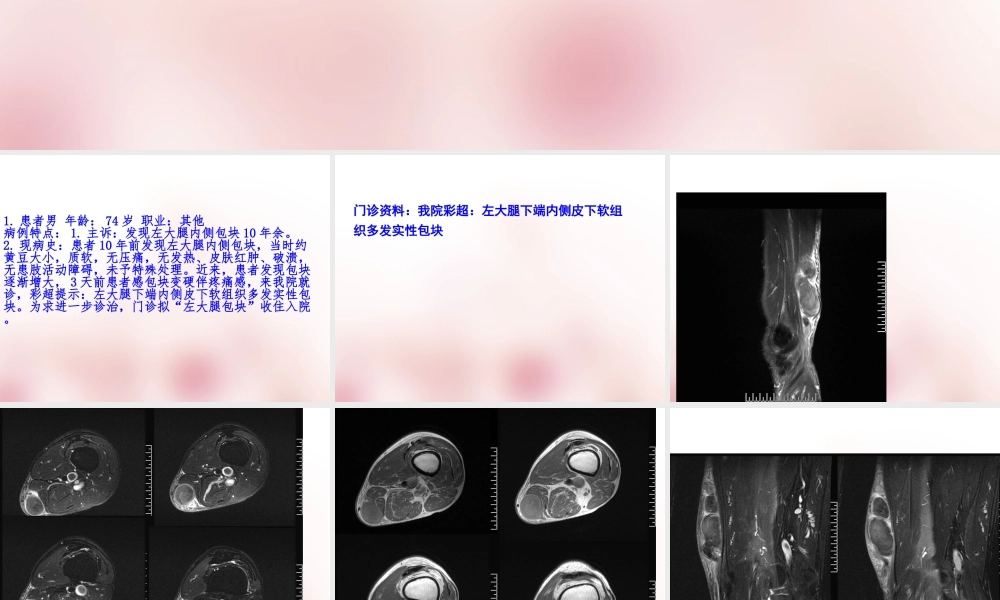 软组织血管瘤ppt.ppt