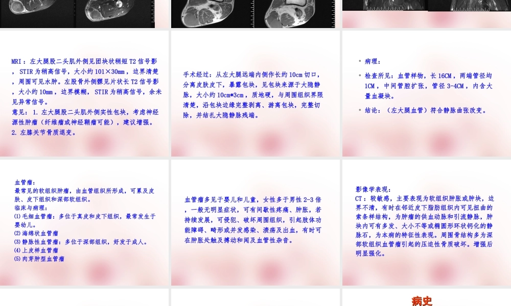 软组织血管瘤ppt.ppt