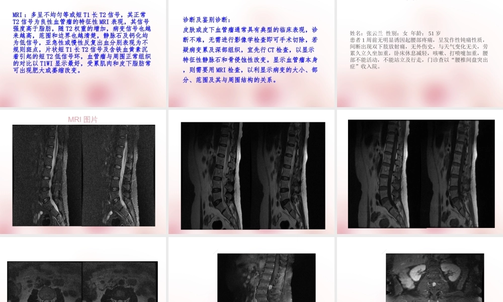 软组织血管瘤ppt.ppt