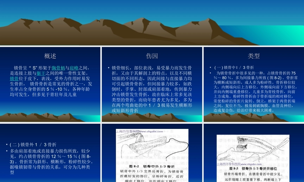 锁骨骨折切开复位钛板内固定术系列.ppt