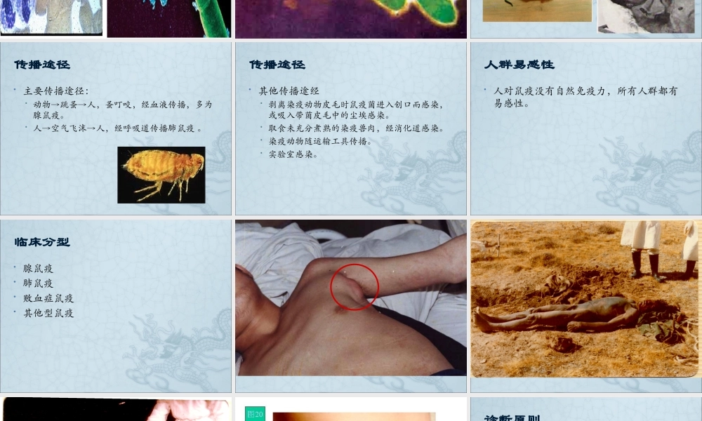 鼠疫及其防制.ppt