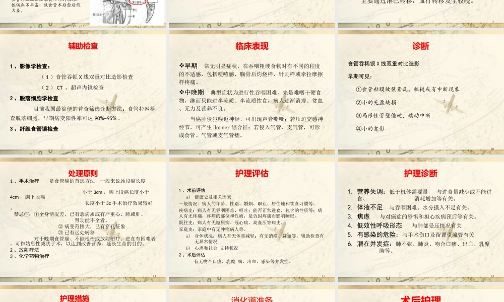 食管癌-20120927详解.ppt