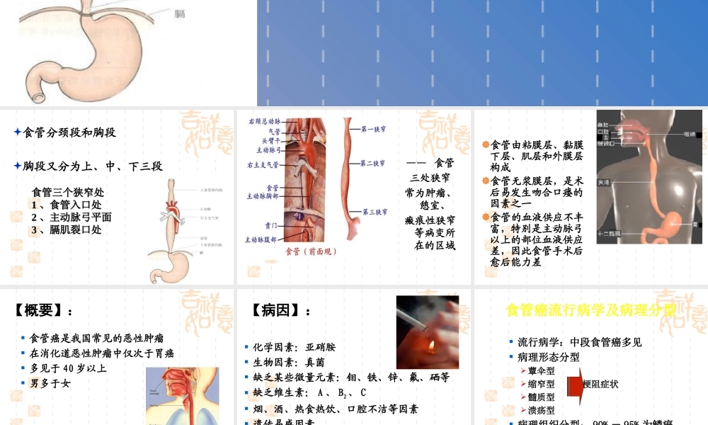 食管癌患者的.ppt
