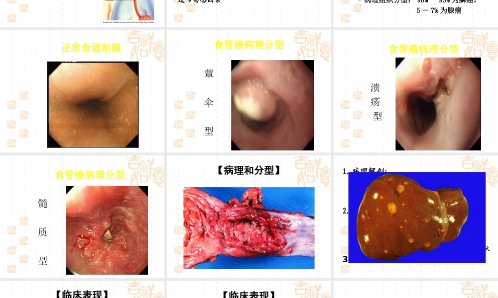 食管癌患者的.ppt
