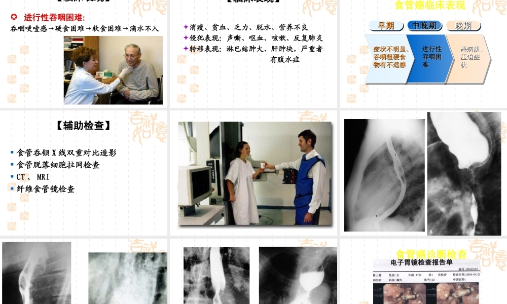 食管癌患者的.ppt