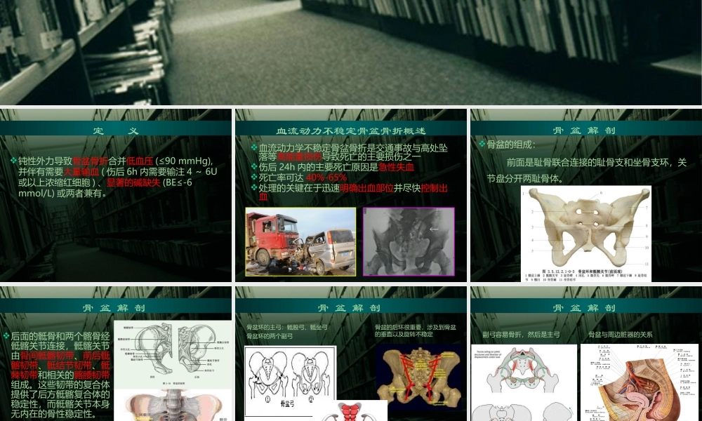 血流动力学不稳定骨盆骨折急诊处理.pptx