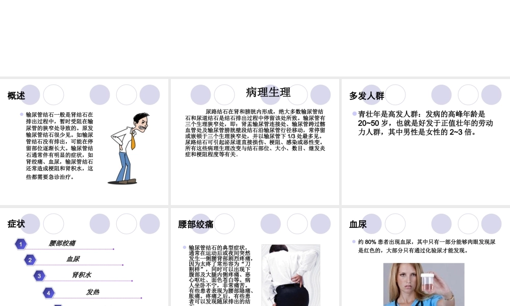 输尿管结石及钬激光碎石术资料.ppt