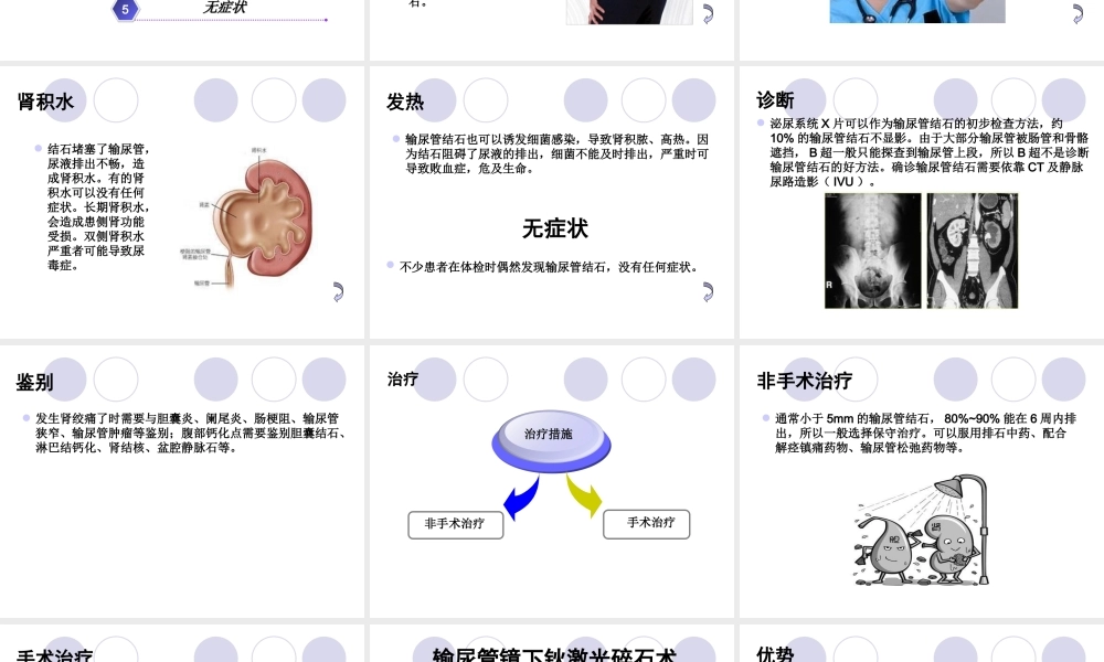 输尿管结石及钬激光碎石术资料.ppt