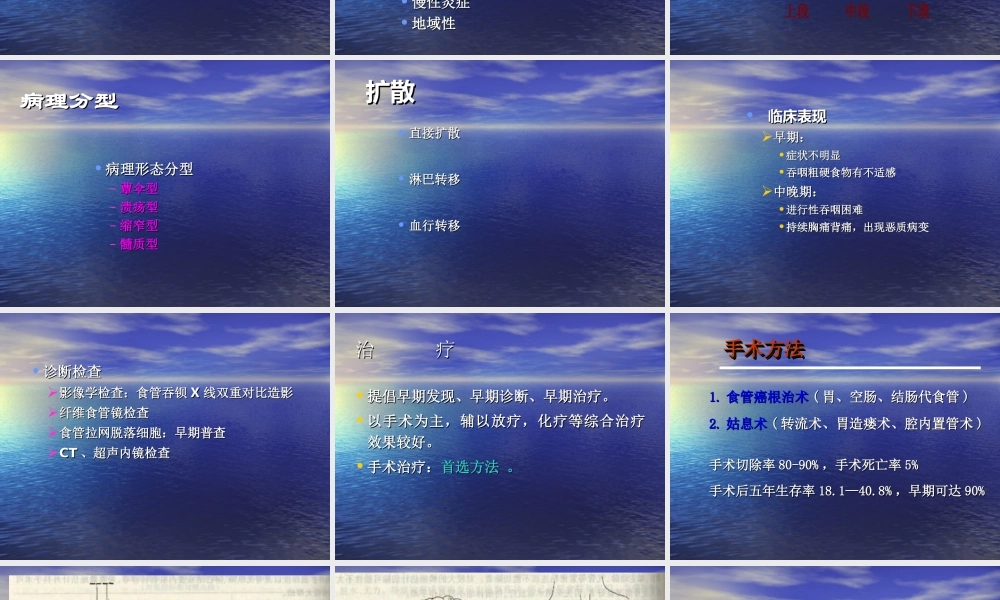 食管癌-讲课-李猛.ppt