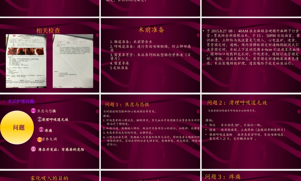 食道胃底结合部癌.ppt