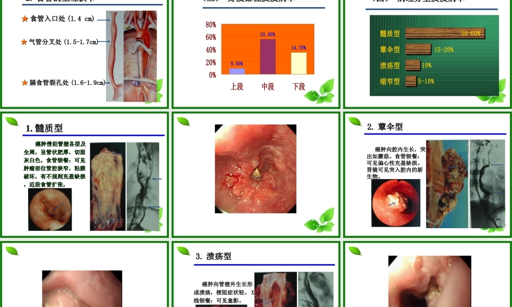 食管癌新资料.ppt