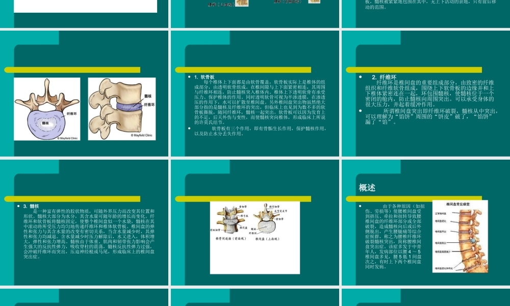 腰间盘脱出症诊治幻灯片.ppt