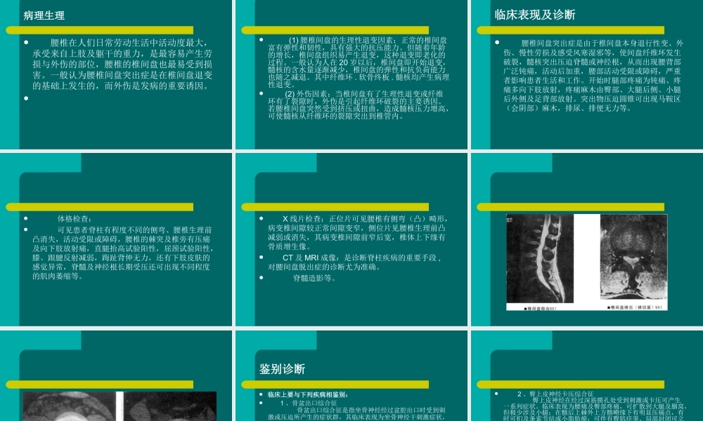 腰间盘脱出症诊治幻灯片.ppt