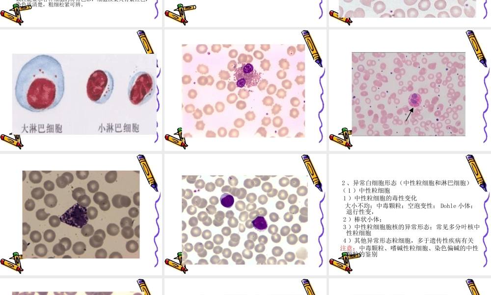 血细胞形态2014.ppt