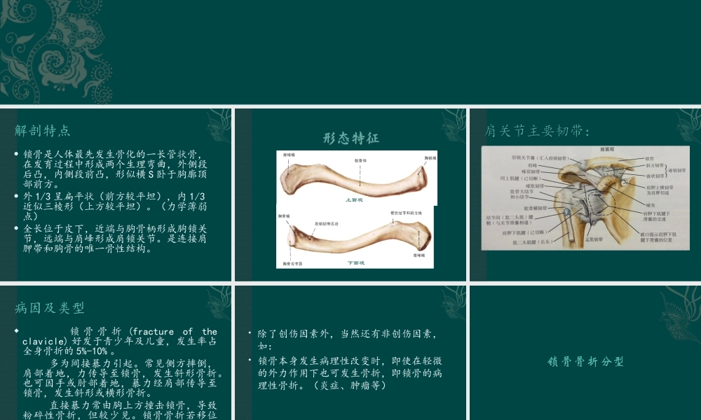 锁骨骨折.ppt