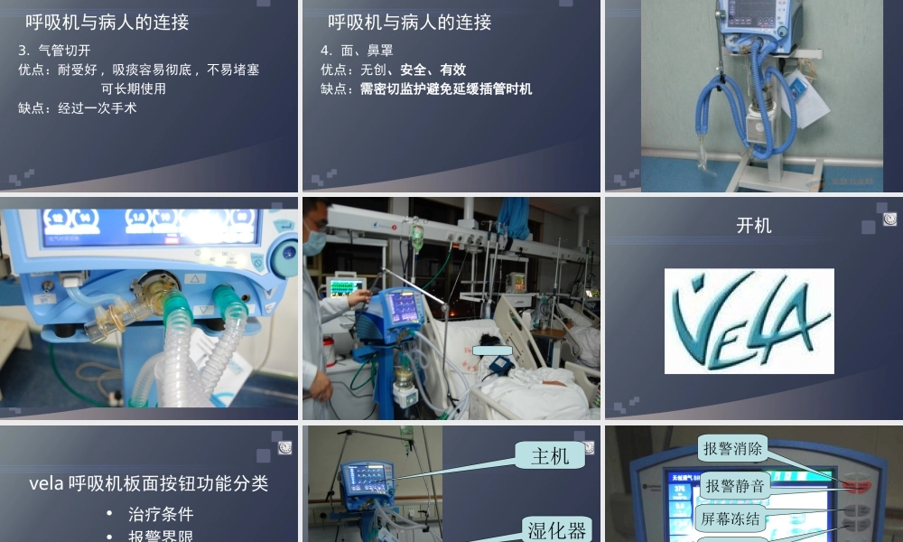 VELA呼吸机.ppt