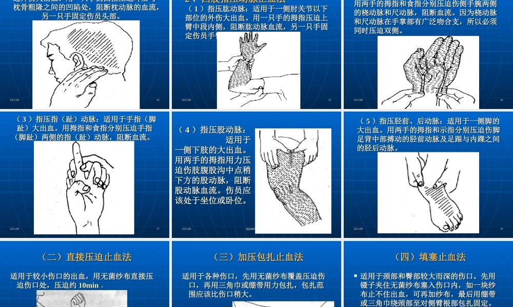 创伤急救讲义(新).ppt